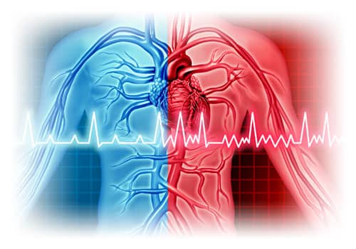 Kammerflimmern-Kammerflattern-Ventrikulare-Herzrhythmusstoerungen-Ventrikulaere-Extrasystolen-Kammertachykardie