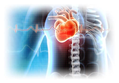 Herzmuskelentzuendung-Myokarditis